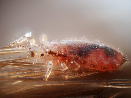 Close-up photo of head louse on human hair